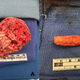 The foam removed from the man’s bladder and urethra.